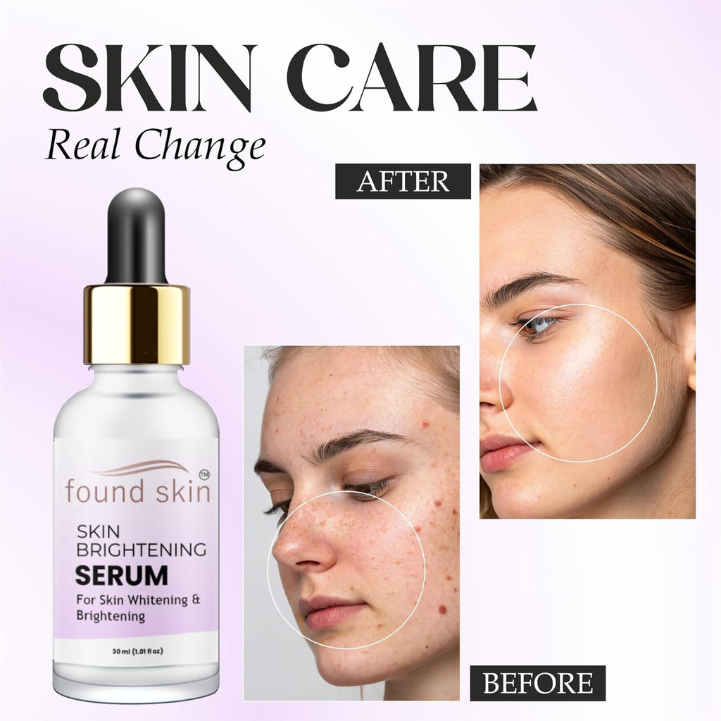 Vitamin C Brightening Serum | Reduces Dark Spots & Hyperpigmentation | Evens Skin Tone & Boosts Glow | Lightweight, Unscented Formula | For All Skin Types | 30ml