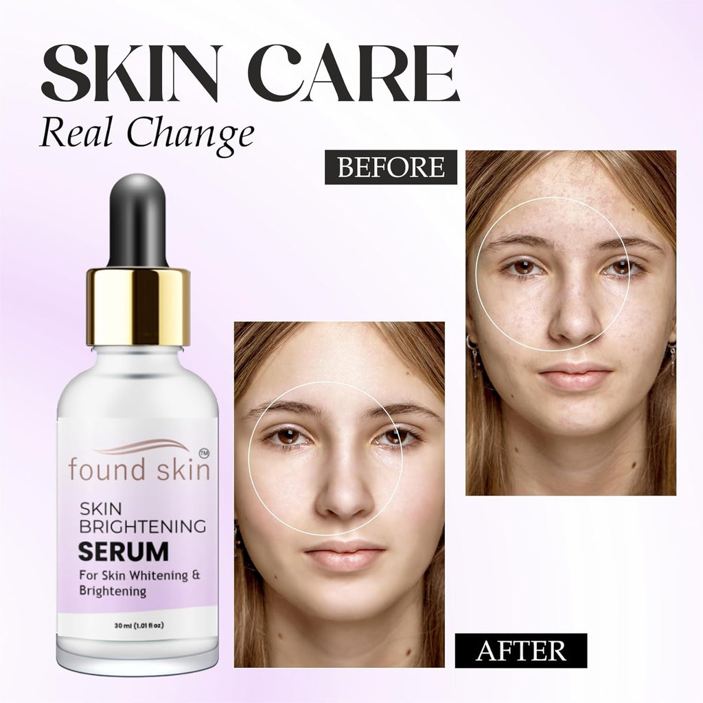 Vitamin C Brightening Serum | Reduces Dark Spots & Hyperpigmentation | Evens Skin Tone & Boosts Glow | Lightweight, Unscented Formula | For All Skin Types | 30ml