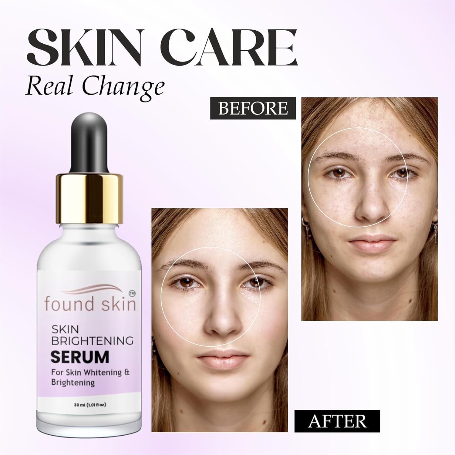Vitamin C Brightening Serum | Reduces Dark Spots & Hyperpigmentation | Evens Skin Tone & Boosts Glow | Lightweight, Unscented Formula | For All Skin Types | 30ml